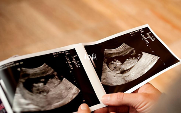 胎停是胚胎停止发育